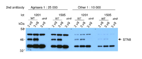 western blot using anti-STN( antibodies