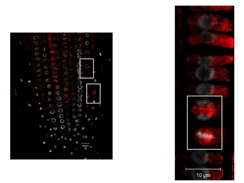 immunolocalization of plant tubulin alpha chain