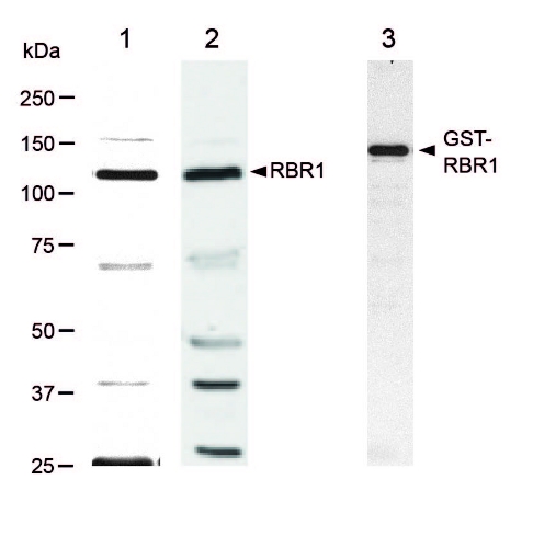 western blot detection of plant retinoblastoma protein