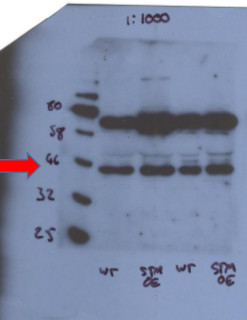 western blot using anti-STM antibodies