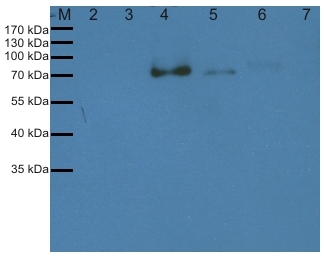western blot using anti-His antibody from Agrisera