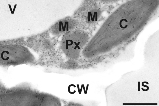 immunogold localization of ACC in plant tissue