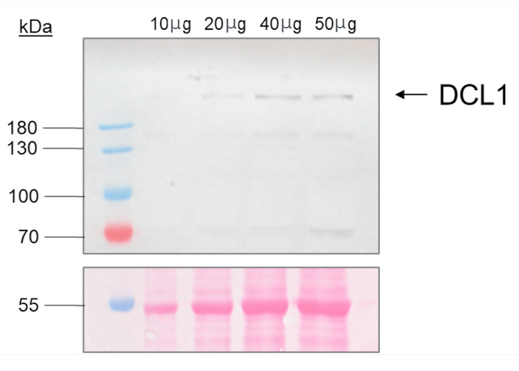 Western blot using anti-DCL1 antibodies