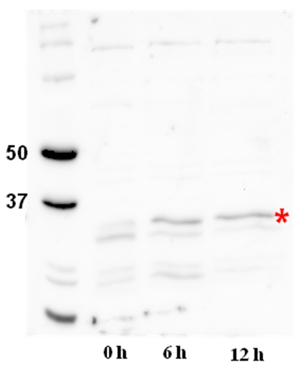 western blot using CrDGAT2 antibodies