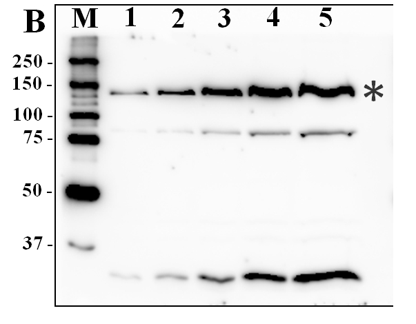 western blot using anti-PADT antibody