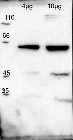 western blot using anti-hexokinase antibodies