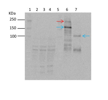 immunoprecipitation using anti-plant TOR antibodies