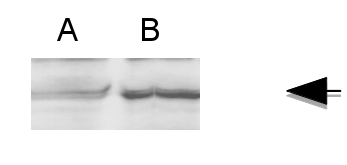 western blot using anti-FMR antibody