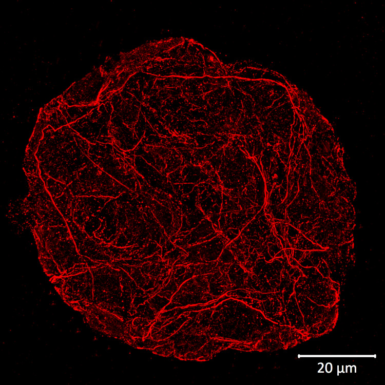 Anti-actin antibody applied in expansion microscopy