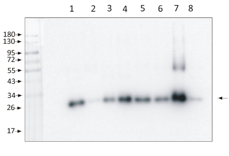 Western blot using anti-Lhcb1, phosphorylated antibodies