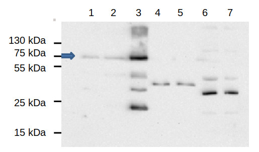 Western blot using anti-EDS1 antibodies