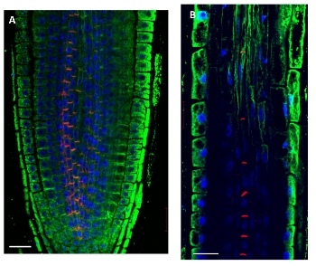 immunolocalization using anti-plant actin antibody