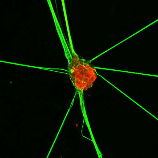 immunofluorescence of neurofilaments with capsaicin antibodies