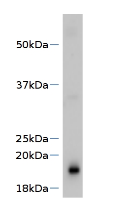 western blot using anti-SVR4 antibodies