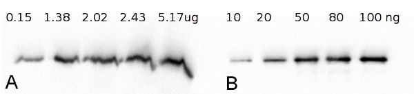 western blot using anti-FBA antibodies