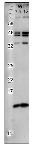 western blot using anti-Trxm antibodies