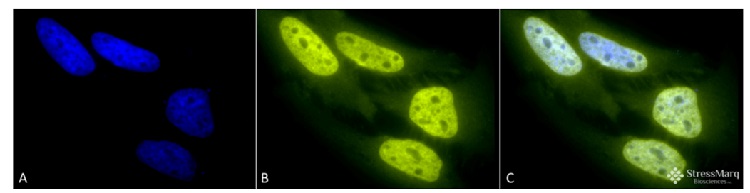 Immunolocalization with anti-acetylated lysine antibodies