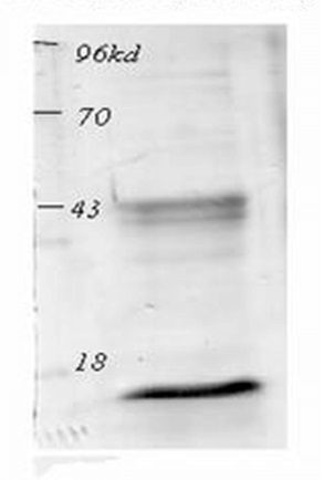 Western blot using acetylated lysine antibodies