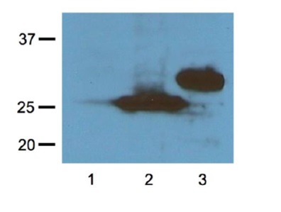 Western blot detection with anti-RFP tag antibodies
