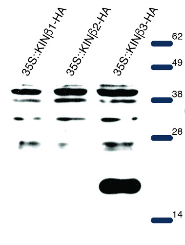 western blot using anti-AKIN beta 3 polyclonal antibodies