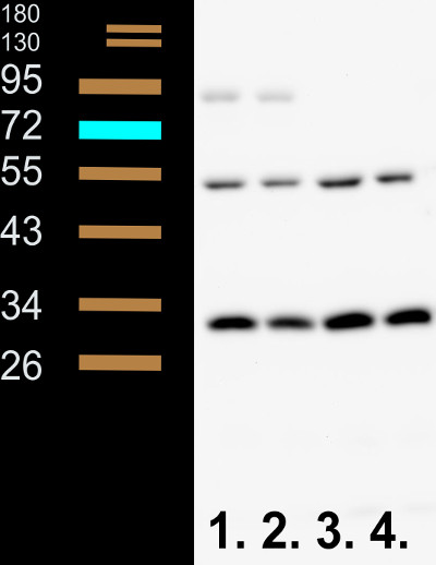 western blot using anti-Phyl antibodies