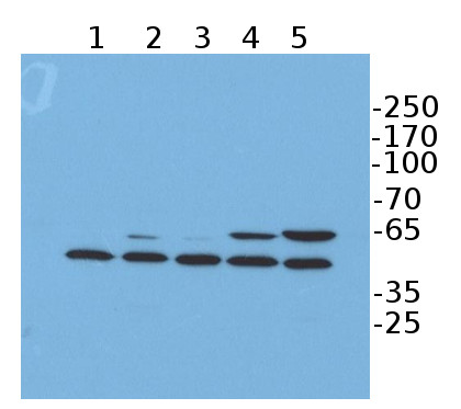 western blot using anti-FLAG antibody