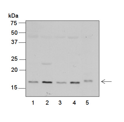 western blot using anti-plant RPS7 antibodies