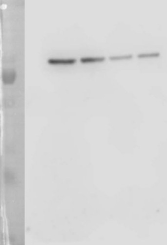 western blot using anti-TKL antibodies