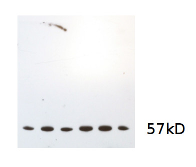 western blot using anti-algal catalase antibodies