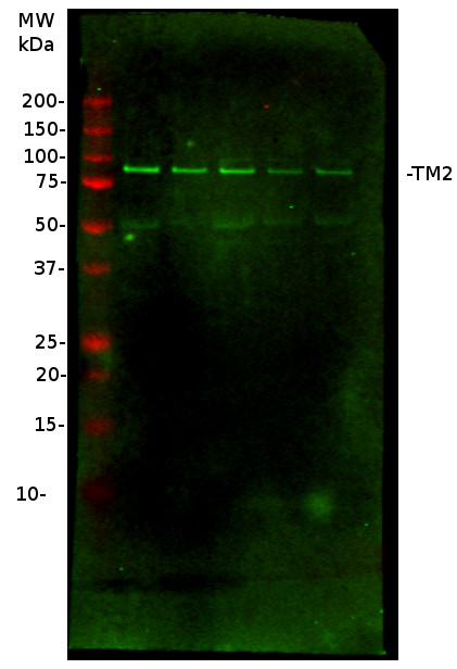 western blot using anti-TM2 antibodies