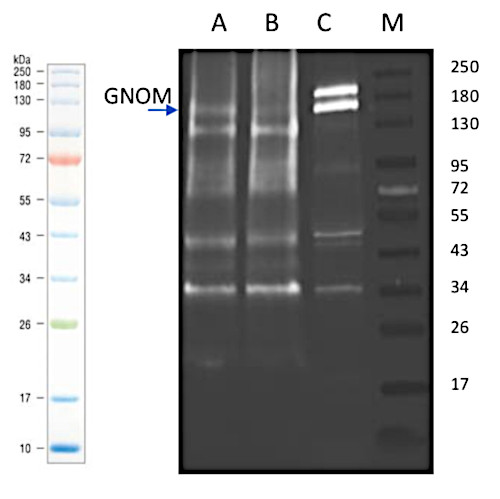 Western blot using anti-GN antibodies