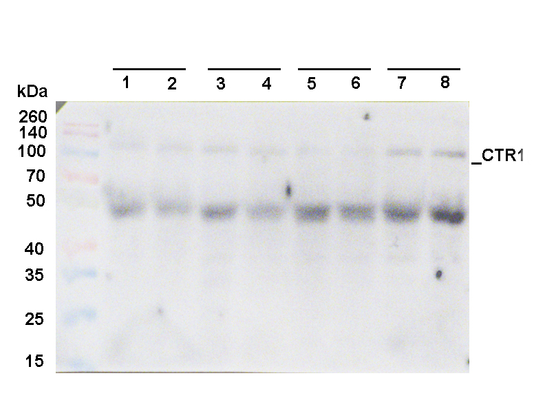 Western blot using anti-CTR1 antibodies