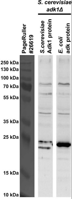 Western blot using anti-ADK antibodies