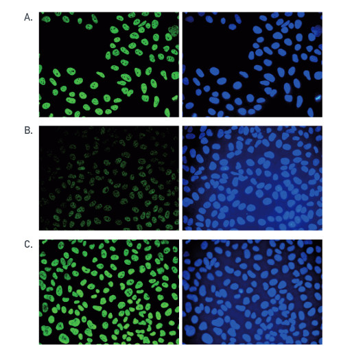 immunofluorescence with monoclonal antibodies to 5-mC (5-methylcystosine)