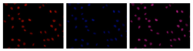 immunofluorescence using monoclonal antibody to 5-mC (5-methylcystosine)