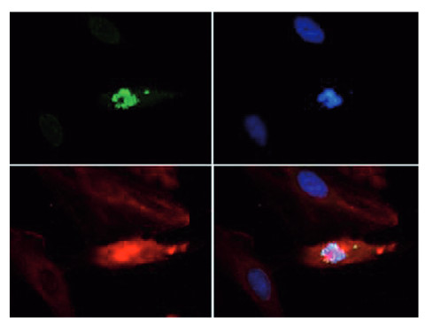 Immunofluorescence using H3T3pK4me1 polyclonal antibodies