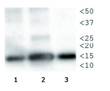 Western blot using anti-H3T3pK4me1 antibodies