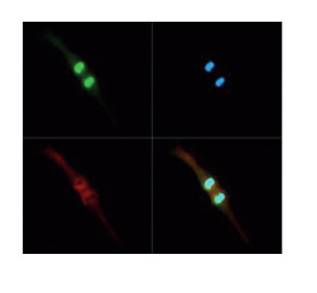 Immunofluorescence using anti-H3T3pK4me2 antibodies