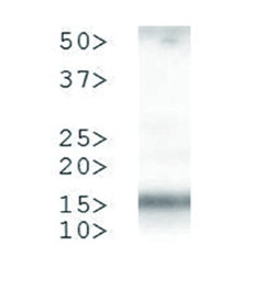 western blot using anti-H3T3pK4me2 antibodies