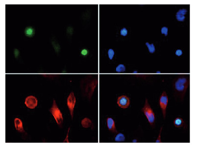 immunofluorescence using anti-phospho-acetyl-Histone H3 antibodies