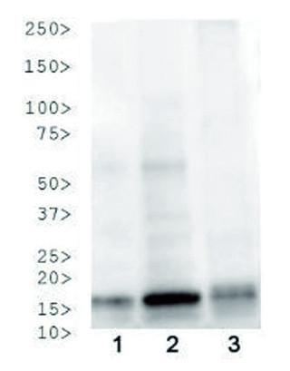 western blot using anti-phospho-acetyl-Histone H3 antibodies