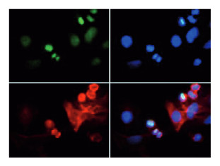 IF using anti-H3K4me3T6p antibodies