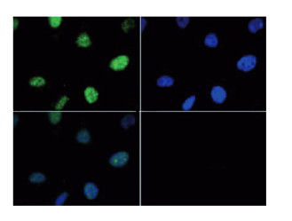 IF using anti-H3T6p antibodies