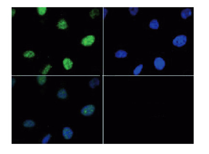 immunofluorescence using anti-H3T6pK9me3 | Histone H3 (trimethyl Lys9, p Thr6) antibodies