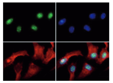 immunofluorescence using anti-H3R8me2(asym) | Histone H3 (asym-dimethyl Arg8) polyclonal antibodies