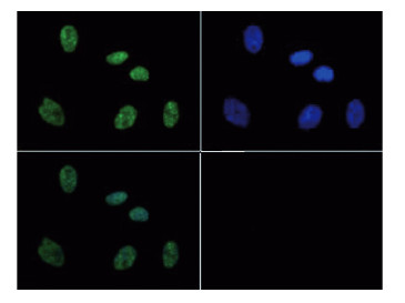 immunofluorescence using anti-H3S10pT11p | Histone H3 (p Ser10, p Thr11) polyclonal antibodiesi