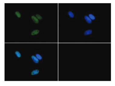 immunofluorescence using anti-H3R17me2(asym) | Histone H3 (asym-dimethyl Arg17)  polyclonal antibodies