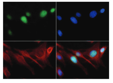 immunofluorescence using anti-H3K18me1 | Histone H3 (monomethyl Lys18) polyclonal antibodies