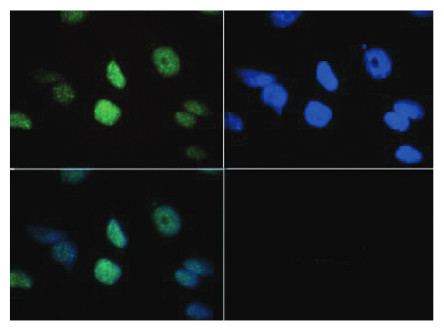 immunofluorescence using anti-H3K18me3 | Histone H3 (trimethylated Lys18) antibodies