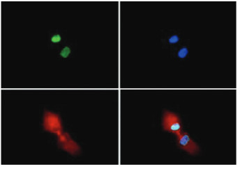 immunofluorescence using anti-H3R2me2(sym)K4me2 | Histone H3 (sym-dimethylated Arg2, dimethyl Lys4) polyclonal antibodies